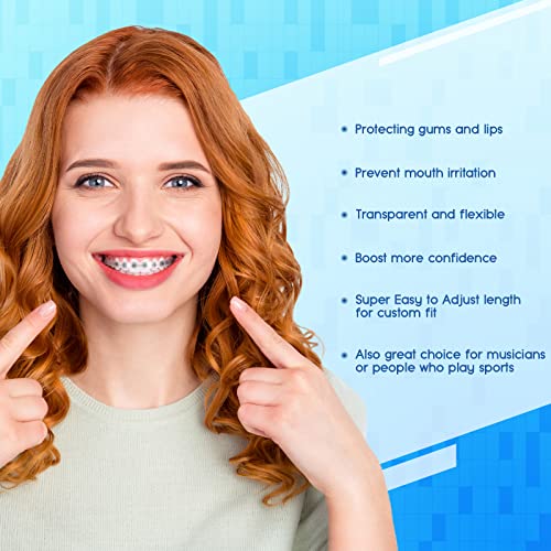 Obrush Clip-On Comfort Covers For Braces, Orthodontic Mouth Guard For Braces, Lip Protector, Wax Alternative, Lip Bumper For Braces, Lip Shield For Brackets, Braces Accessories #TOP1
