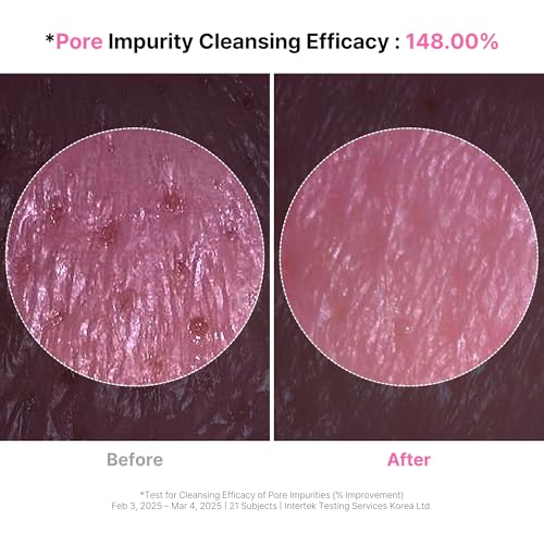 Image of 4-in-1 Konjac Jelly Face Cleanser - Gentle Daily Exfoliating, Deep Cleansing, Pore Care & Makeup Removal | Berry Smoothie Texture with Raspberry & Vitamin B+C+E Complex | Dermatologist-Tested - 130 ML