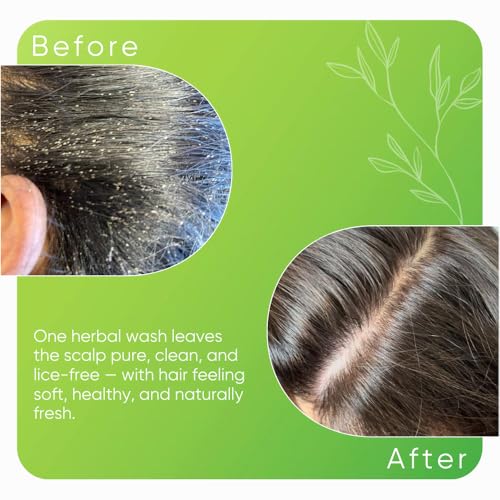 Image of Neem & Tulsi Anti-Lice & Nits Shampoo 200ml