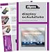 Produktbild dipos I 2X Schutzfolie klar kompatibel mit Lenovo Yoga Smart Tab 10.1 YT-X705F Folie Displayschutzfolie