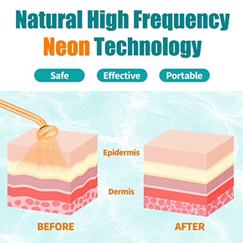 High Frequency Facial Wand - Tumakou Portable High Frequency Facial Skin Machine - With 4 Glass Tubes #TOP3