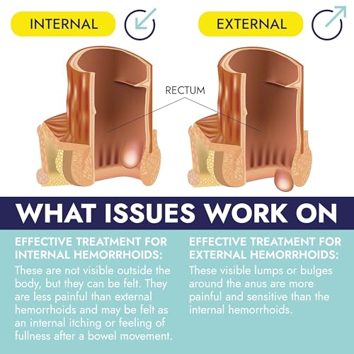 Image of Hemorrhoid Suppository for Pain, Burning & Itching Relief | Effective Hemorrhoid Treatment for Swelling, Irritation & Discomfort | Soothes & Supports Recovery for Lasting Comfort | 24 Suppositories
