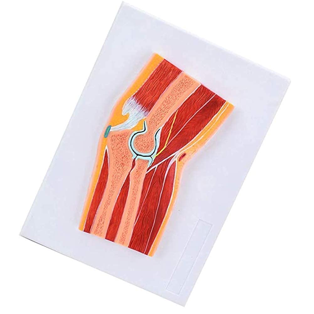 Model anatomiczny Rekwizyty do nauki Model mięśni szkieletowych stawu łokciowego-Struktura stawu łokciowego MRI Staw-anatomia Ortopedia Nauczanie-Materiał PCV. Ręcznie robiony kolorowy obraz