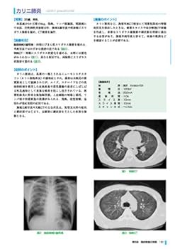 診療画像検査法　7冊 診療画像検査法X線撮影法 |本 | 通販 | Amazon