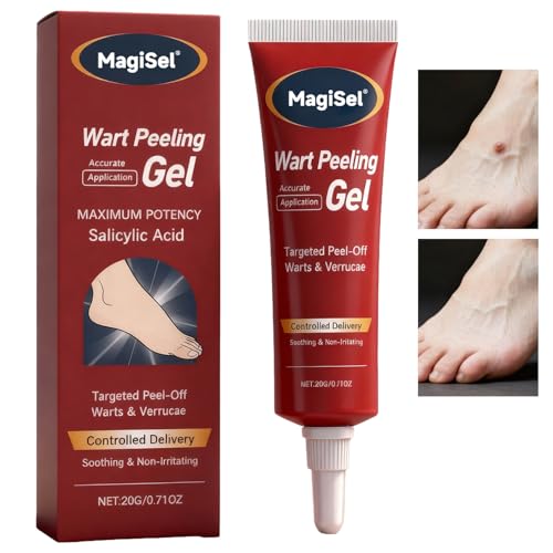 Verruche Rimozione Crema, Verruca Rimozione Della Pelle, Crema Per Il Sollievo Di Verruche, Sicuro Per La Pelle Sensibile, Rimoziones Delle Verruches pers Mani, Viso e Corpo 20G