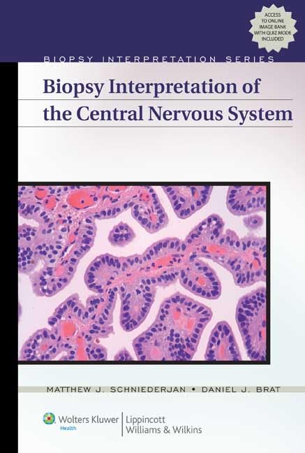 Buy Biopsy Interpretation of the Central Nervous System — BookShops.in