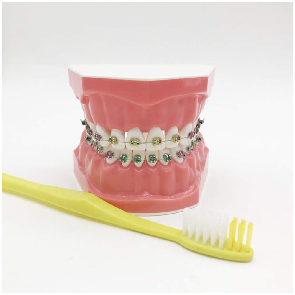 Modello Di Denti Per La Formazione - Modello Ortodontico - Modello Di Insegnamento Dei Denti Con Staffa In Metallo E Ceramica - Modello Di Formazione Correttiva Dei Denti Per L'insegnamento Dell'igien