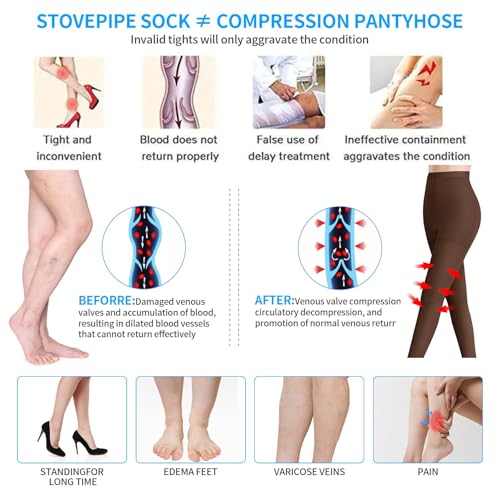 Image of Medical Compression Pantyhose for Women Support Stockings 20-30 mmHg Treatment Swelling, Edema Varicose Veins