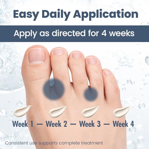 Image of Antifungal Cream for Athlete's Foot - Relieves Itching, Cracking & Redness, Fast-Acting Skin Ointment for Jock Itch & Ringworm - Non-Greasy & Absorbs Quickly - 20 gm | 1-Pack