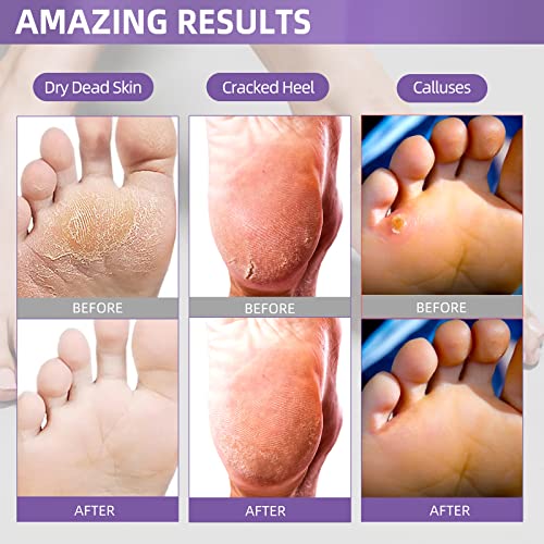Soonuly Foot Peel Mask With Lavender - 1 Pack Exfoliating Foot Mask For Dry Cracked Feet, Dead Skin And Calluses - Foot Mask Peel For Baby Soft Feet Peeling Mask #TOP1