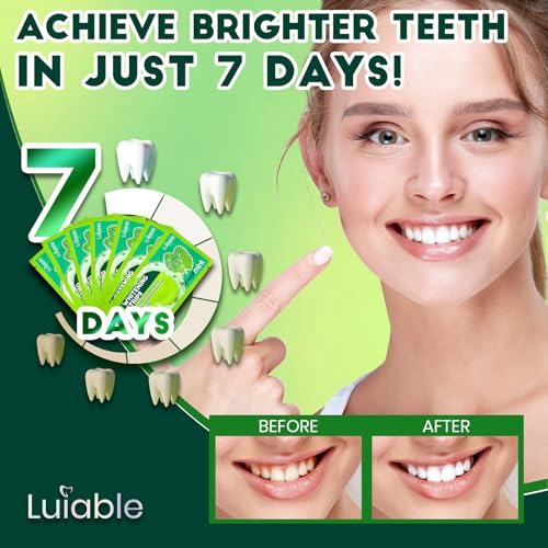 Image of Teeth Whitening Strips for Tooth White: Professional Dentist Formulated Teeth Whitener Enamel-Safe Non-Slip 14 Strips 7 Treatments (14 Count (Pack of 1), Spearmint)