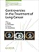 Produktbild Controversies in the Treatment of Lung Cancer: 12th International Symposium on Special Aspects of Radiotherapy, Berlin, October 2008. (Frontiers of Radiation Therapy and Oncology, Band 42)