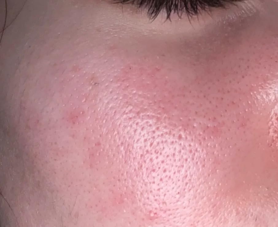 Absolutely love this product