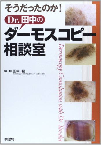 無料電子書籍 おすすめ そうだったのか!Dr.田中のダーモスコピー相談室 バイ