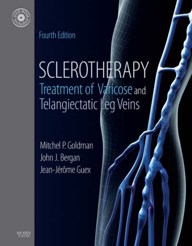 Sclerotherapy: Treatment of Varicose and Telangiectatic Leg Veins