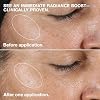 Clinique 3-Step Clarifying Lotion Face Exfoliator 2 | Toner With Witch Hazel | For Dry Combination Skin Types