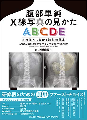 キンドル 無料電子書籍 腹部単純X線写真の見かたABCDE 2枚並べてわかる読影の基本 バイ