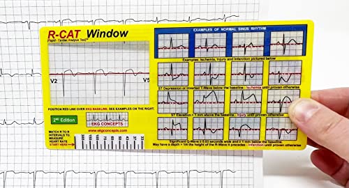 Fenêtre R-Cat EKG 2e édition solution lecture ECG sans erreur de tracé