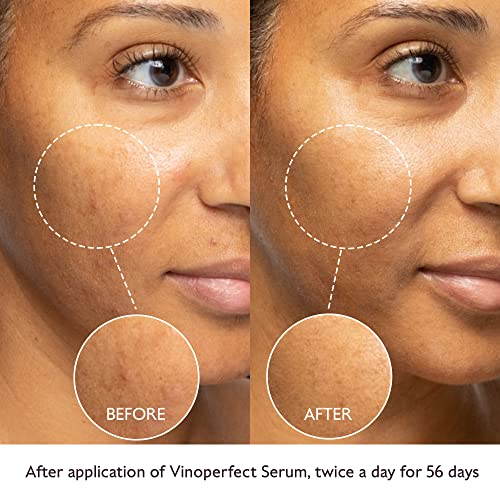 Caudalie Vinoperfect Radiance Dark Spot Serum - 62X More Effective Than Vitamin C (Serum) #TOP2