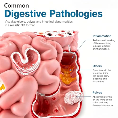 Image of Human Digestive System Model with Removable Stomach, GI-Tract and Colon, Includes Product Manual