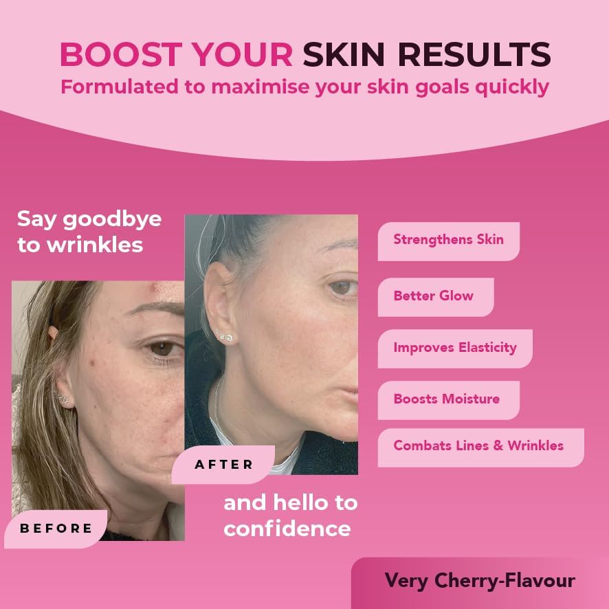 Reverse Life - Limited Edition Very Cherry Skin Booster - 5,000mg Hydrolysed Collagen with Biotin, Vitamin C, B12 & Folic Acid - 30-Day Dose - Collagen Supplements - 450ml 51NIdjXba9L. AC