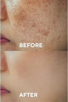 The Ceel Anti-Blemish and Skin Tint Synchronizing Skin Serum, 30 ml Effective in Glutathione & Niacinamide