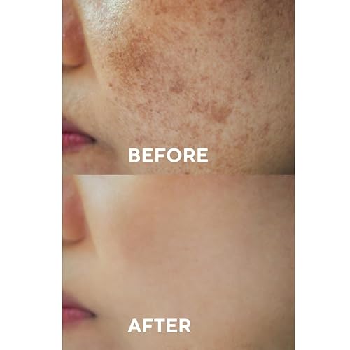 Miniatura 4 de The Ceel Suero corrector de manchas oscuras con glutatión y niacinamida  Suero facial iluminador para tono de piel desigual, hiperpigmentación y