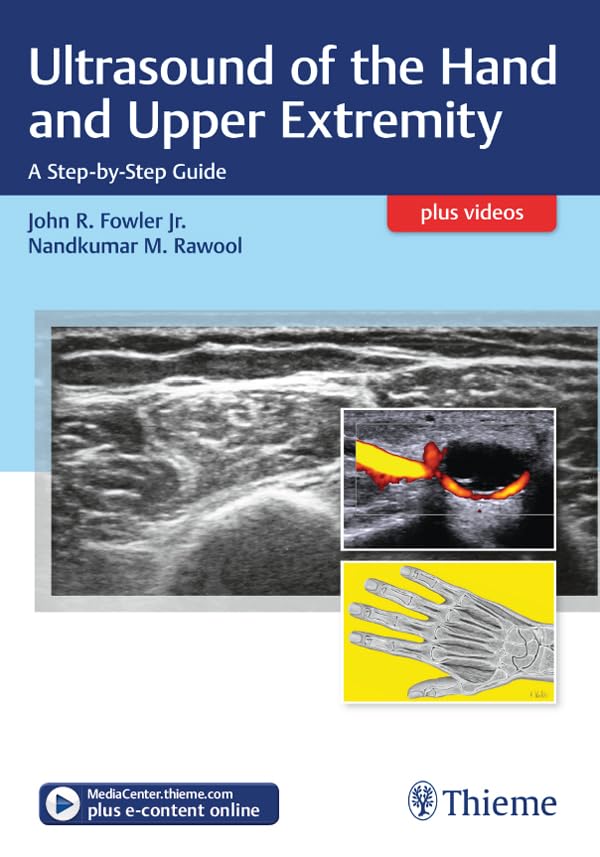 Ultrasound of the Hand and Upper Extremity: A Step-by-Step Guide (English Edition)
