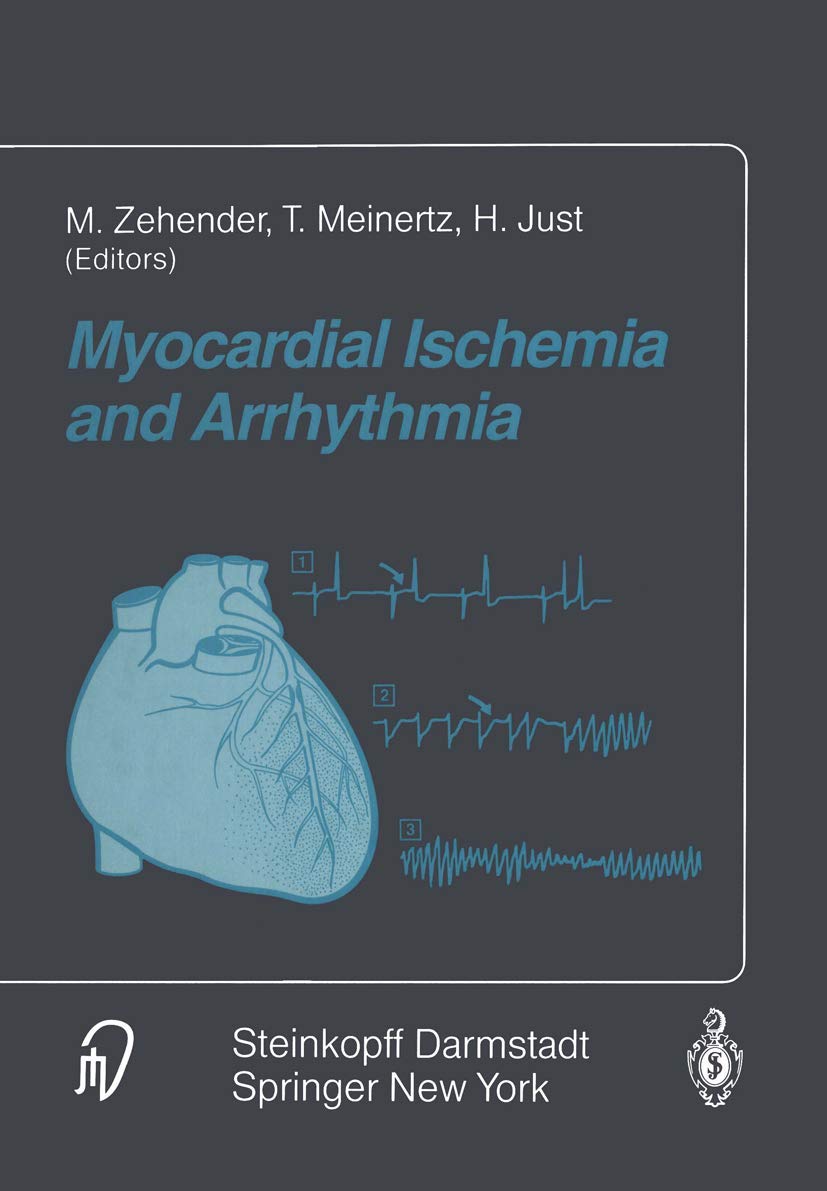 Buy Myocardial Ischemia and Arrhythmia: Under the auspices of the Society of Cooperation in Medicine and Science (SCMS), Freiburg, Germany — BookShops.in