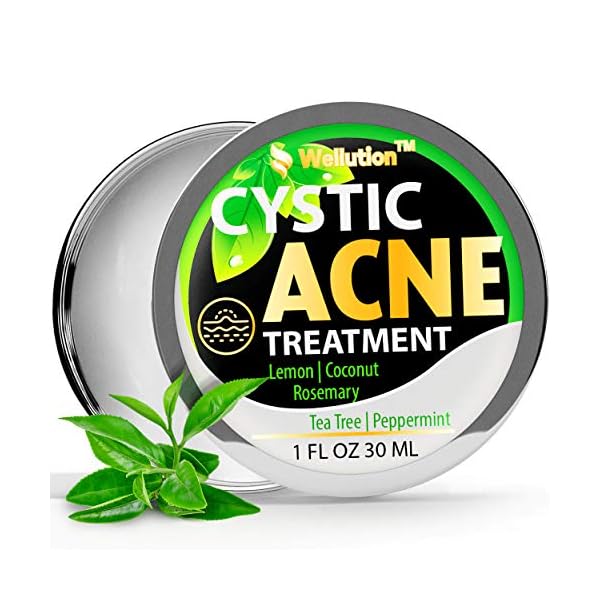 Cystic-Acne-Treatment-and-Acne-Scar-Remover-Made-in-USA-Effective-Face-Body-Severe-Acne-Cleanser-with-Tea-Tree-Oil-Prevent-Future-Breakouts-Natural-Acne-Spot-Pimple-Cream Wellution Cystic Acne Treatment Cream - Natural Pimple and Scar Remover with Tea Tree Oil - Effective Overnight Face Treatment for Acne Spots, Pimples and Scars - 1oz