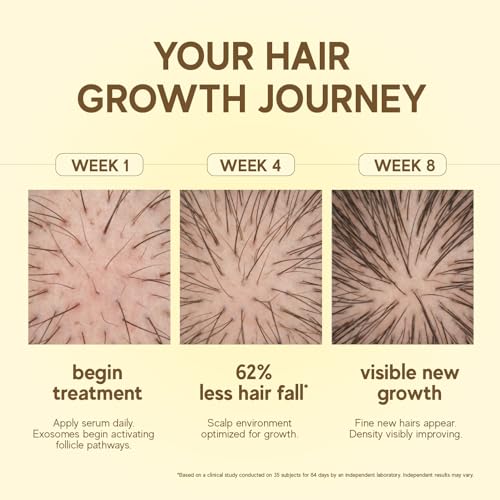 Image of indē wild Moonlight Overnight Scalp Serum | Lightweight, Water-based Hair Growth Serum for Thicker, Fuller, Healthier-looking Hair & Scalp | Rosemary, Bhringraj with 9% Hair Growth Complex | 10ml