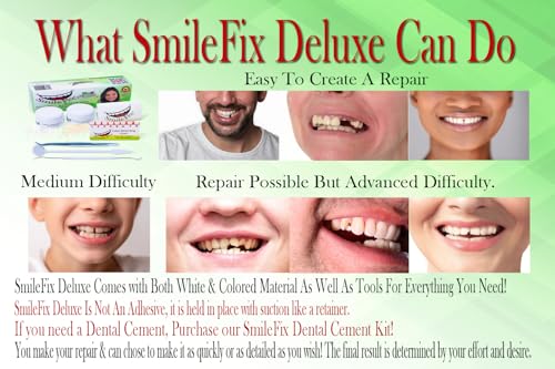 SmileFix Deluxe Dental Repair Kit - Color Matching Compound - Includes Tools - Missing Or Damaged Teeth - Fix Gaps, Broken Teeth - Durable Tooth Repair - Fast & Easy Process