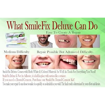 SmileFix Deluxe Dental Repair Kit - Color Matching Compound - Includes Tools - Missing Or Damaged Teeth - Fix Gaps, Broken Teeth - Durable Tooth Repair - Fast & Easy Process