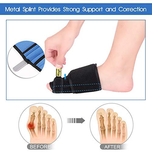 image for Yosoo Health Gear Bunion Corrector, Night Sleep Bunion Relief Protecto