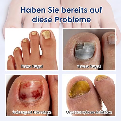 32 Fungal Nail Patches, Nagelpilz, Nagelpilz Pflaster,Toenail Correction Patch, Multi-Purpose Toenail Repair Pads, Toenail Patches For Damaged Nails And The Appearance Of Discoloured Nails