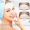 Forehead-Mask-Forehead-Pad-JUYOU-Anti-Wrinkle-Forehead-Patch-Firming-Collagen-Anti-Wrinkle-Gel-Forehead-Sticker-Reduce-Fine-Lines-Moisturizers-Deeply-Repairs-6Packs Forehead Mask, Forehead Pad, JUYOU Anti-Wrinkle Forehead Patch, Firming Collagen Anti-Wrinkle Gel Forehead Sticker, Reduce Fine Lines Moisturizers Deeply Repairs (6Packs)
