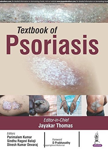 Psoriasis by Jayakar Thomas (2016-04-30)