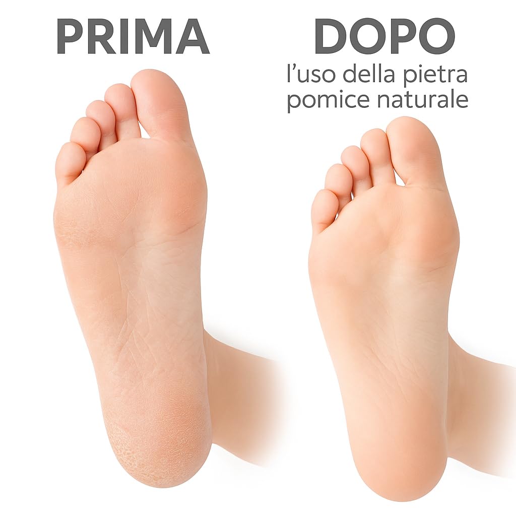 Terryshop74 Set 2 Pietre Pomice Naturali Ovali 9×6×3 cm – Rimuove Calli e Durezza Piedi e Mani – Delicate, Efficaci, 100% Naturali