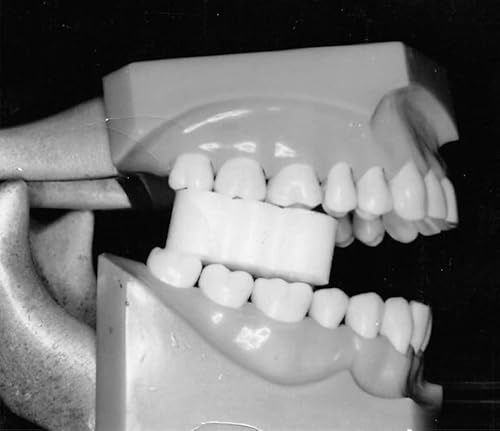 Ez-Prop RT-EZPROP Ez Prop ® Disposable Mouth Prop thumb #7