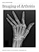 Imaging of Arthritis