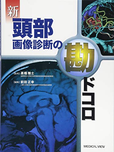 オライリー 無料電子書籍 新 頭部画像診断の勘ドコロ バイ