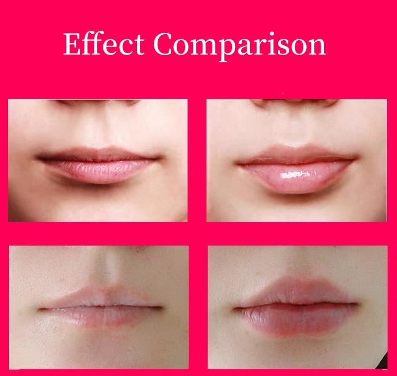 Miniatura 2 de Herramienta para rellenar labios, plumper eléctrico para labios, dispositivo de relleno de labios, herramienta de relleno de labios, plumper de