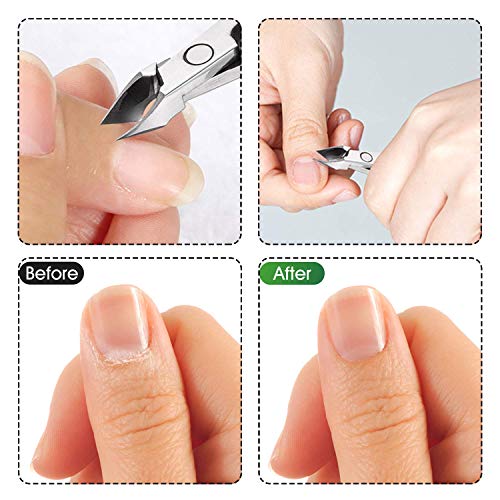 Cuticle Nippers Cuticle Trimmer Remover Clippers Stainless Steel Cutter Extremely Sharp Scissors Manicure Tool Nail Care, Opove X7 Black #TOP5
