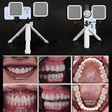 Zoom IMG-2 ngary luce di riempimento dentale Zoom IMG-2 ngary luce di riempimento dentale