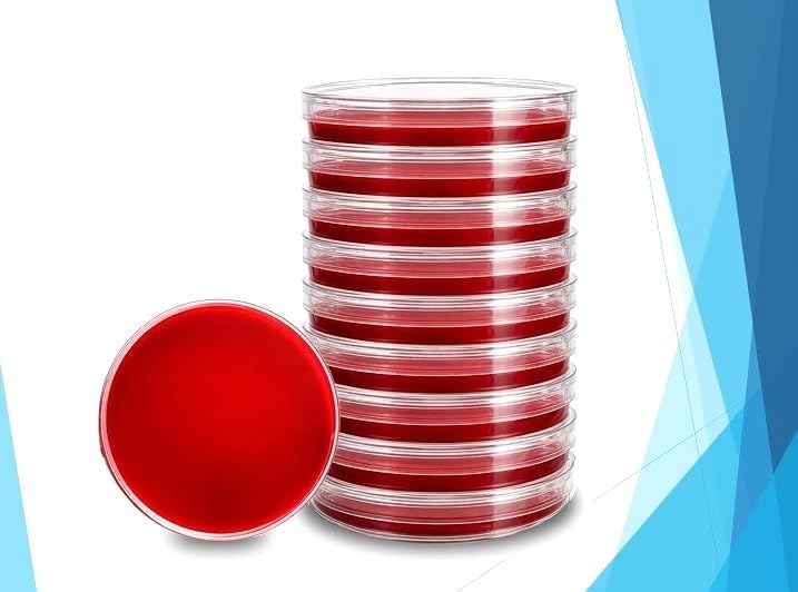 Red Blood Agar (TSA w/ 5% Sheep Blood)) Pre-Poured Agar Plates | 15mm x 100mm Petri Plates | Made in USA