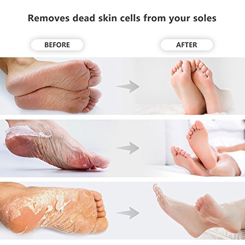 Maschera dei Piedi, 2 Paia Maschera Piedi Peeling