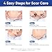 Aroamas Scar Silicone Scar Tape - Medical-Grade Silicone Scar Sheets to Help Improve The Appearance of Scars and Scratch Marks, Reusable for Face & Body [3