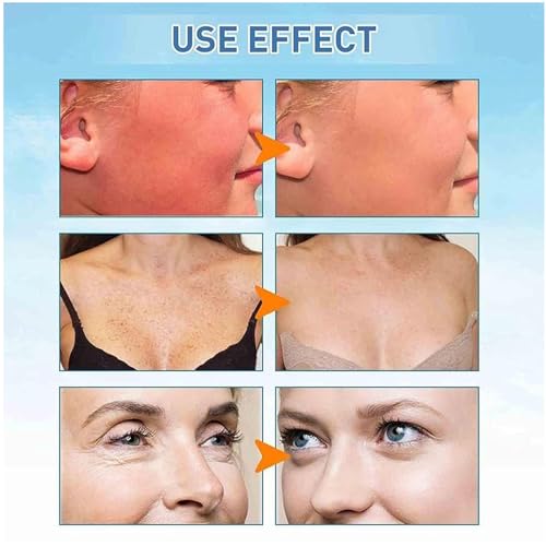 Sunscreen SPF 50, Water-fit Sun Serum, Madagascar Sunscreen, No Sticky Refreshing Universal Sunscreen UV Defense (3pcs) - Thumbnail 6