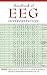 Handbook of EEG Interpretation