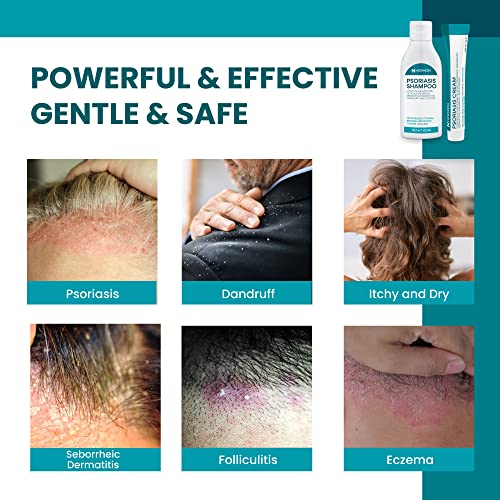 Psoriasis Cream Shampoo Set, Psoriasis Scalp Treatment, Seborrheic Dermatitis Shampoo, Soothe Dry Skin & Inflammationï¼Treat Itchy & Dandruff (30g + 120ml) - Image 3